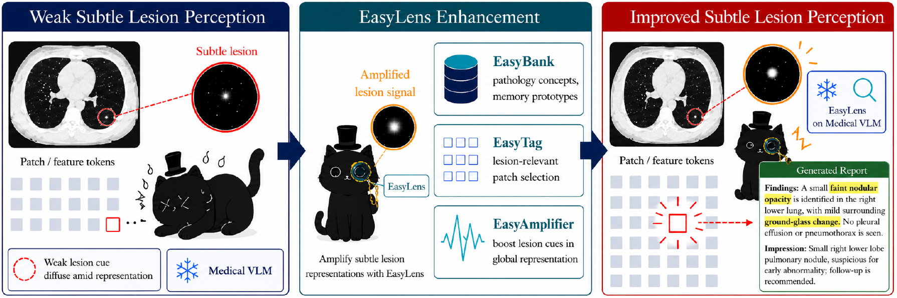 Overview of subtle-lesion amplification with EasyLens