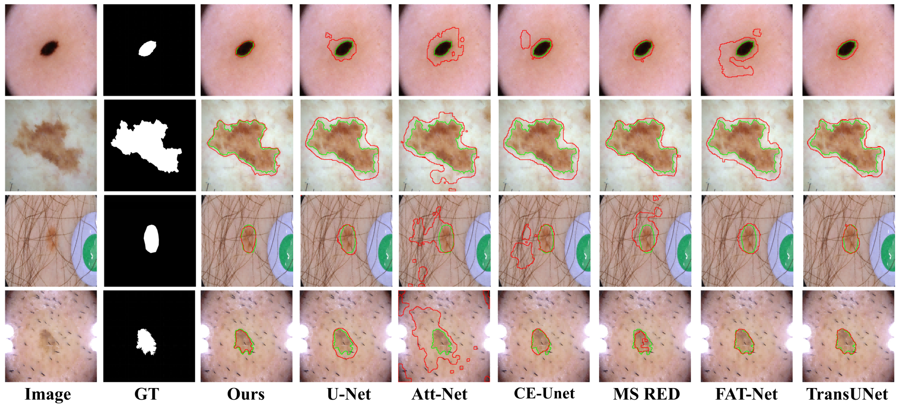 ISIC segmentation comparison