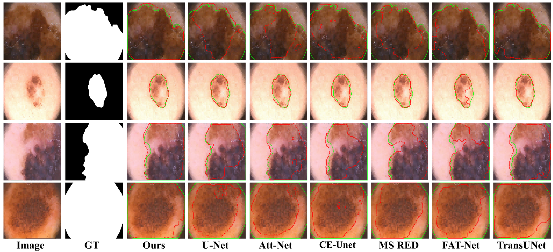 ISIC 2016 and PH2 segmentation comparison