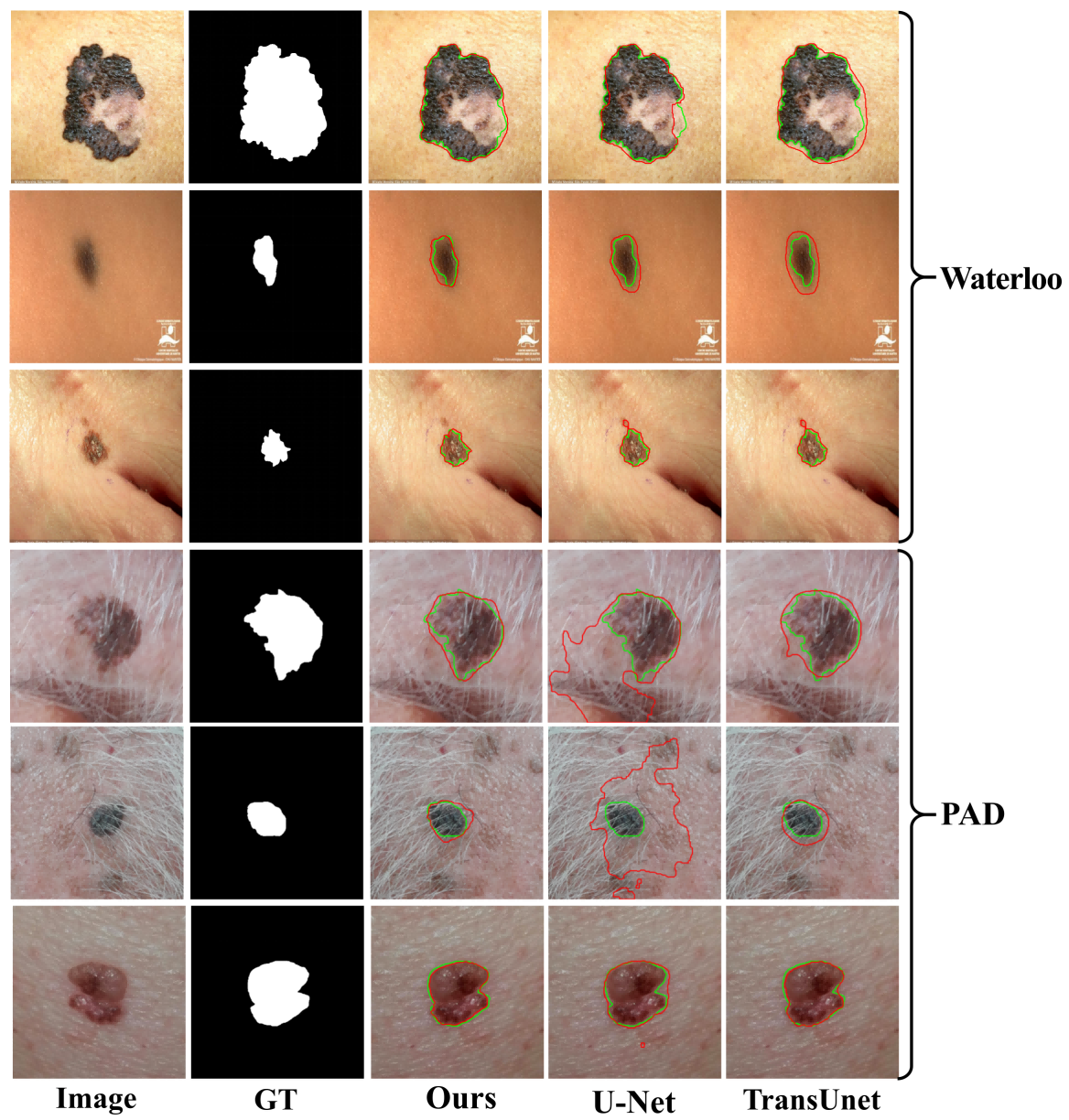 Mobile phone dataset segmentation comparison