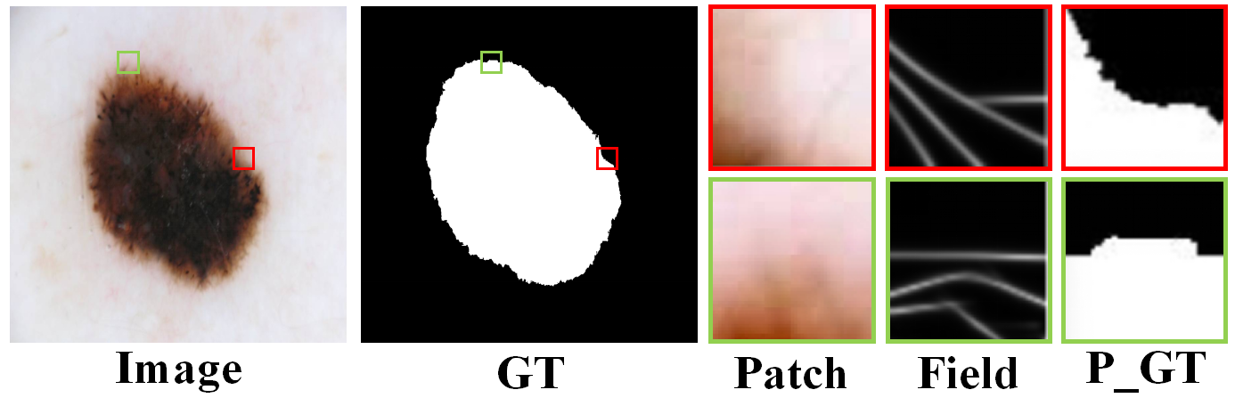 Morphology-aware module illustration