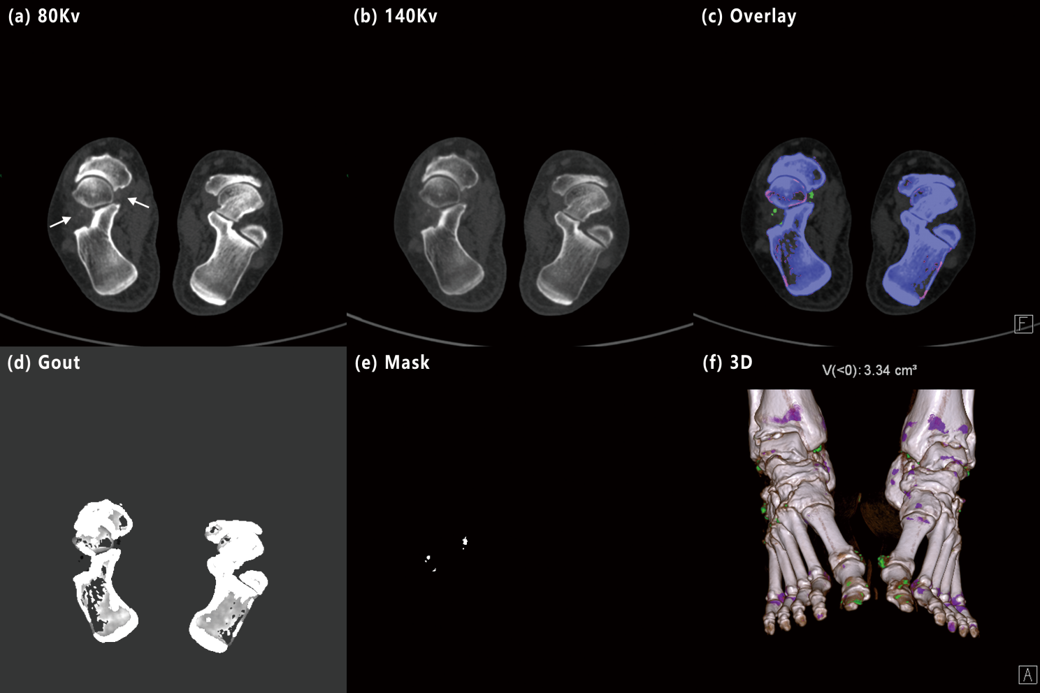 Virtual DECT generation results