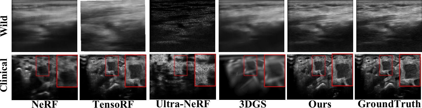 Visual reconstruction comparison on Wild and Clinical Dataset