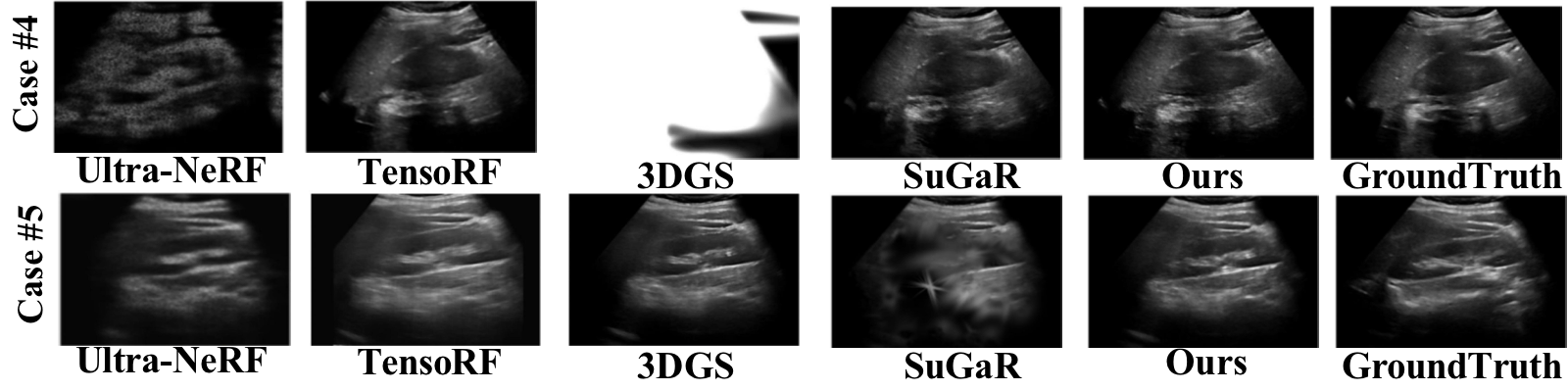 Kidney visualization comparison